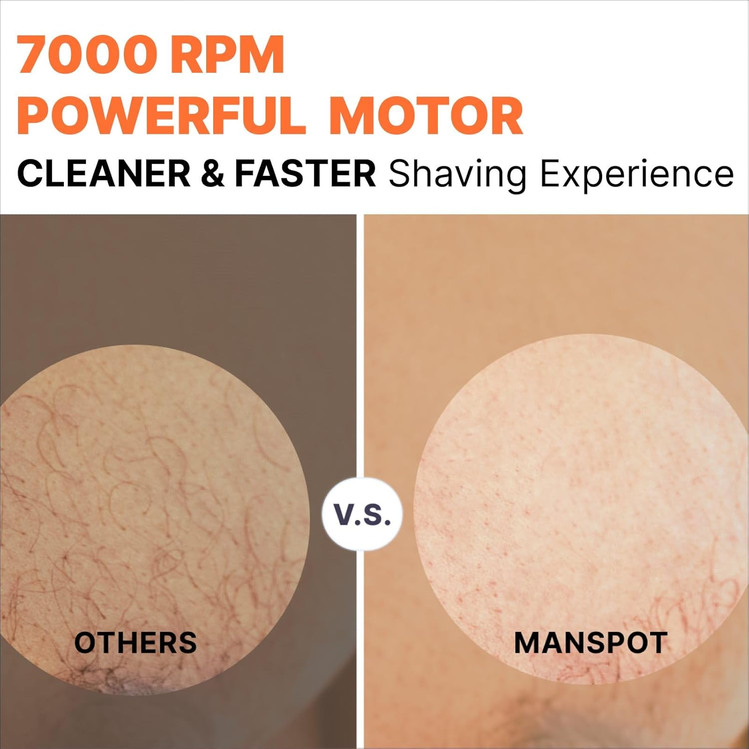 MANSPOT Manscape Groin & Body Hair Trimmer for Men, Electric Ball Pubic Trimmer Shaver,Manscape Kit with 4 Guard,Replaceable Ceramic Blade Heads,Waterproof Wet/Dry Shaver,90 Minutes Shaving