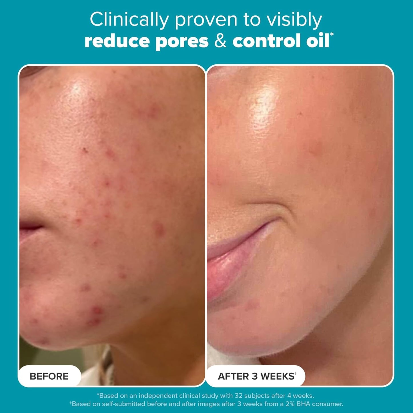 Paula's Choice SKIN PERFECTING 2% BHA Liquid Exfoliant Polish, Salicylic Acid Exfoliant-Facial Polish for Enlarged Pores, Wrinkles & Fine Lines, Suitable for Blackhead-Prone Skin, Fragrance-Free